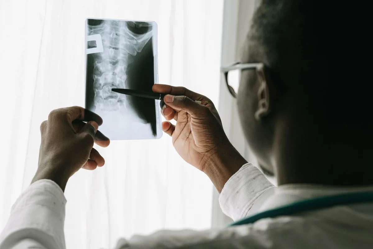 A physician reviewing a spine X-ray showing a vertebral compression fracture with the patient.
