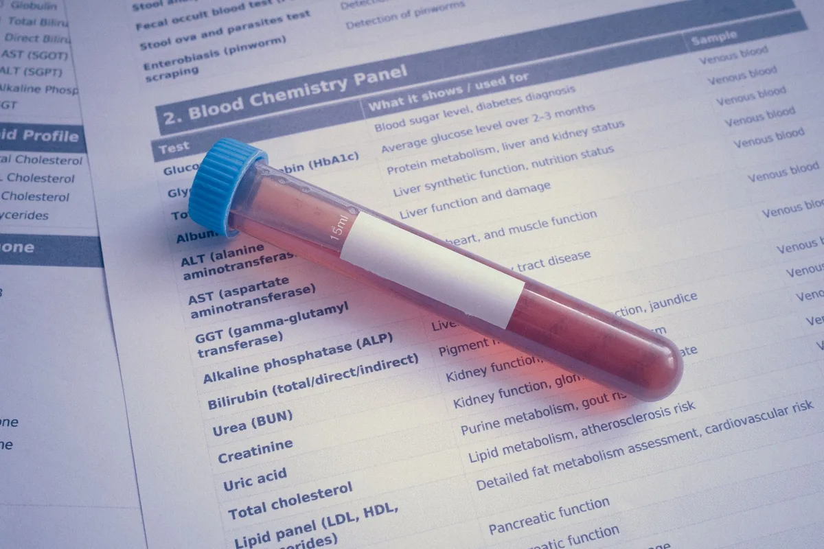 Blood sample vials prepared for laboratory testing.