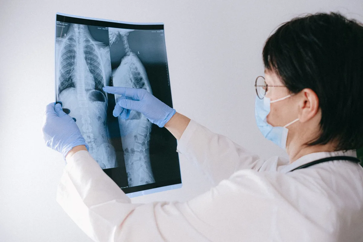 A radiofrequency probe positioned under fluoroscopic guidance near the spine during a nerve ablation procedure.