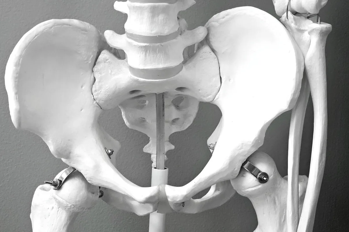 A fluoroscopic image-guided injection targeting the sacroiliac joint.