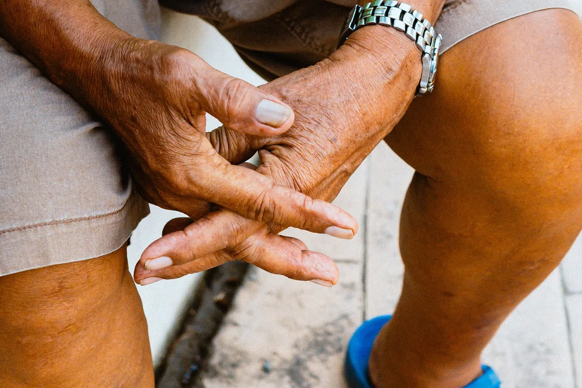 An older adult seated with weathered hands resting over the knees.