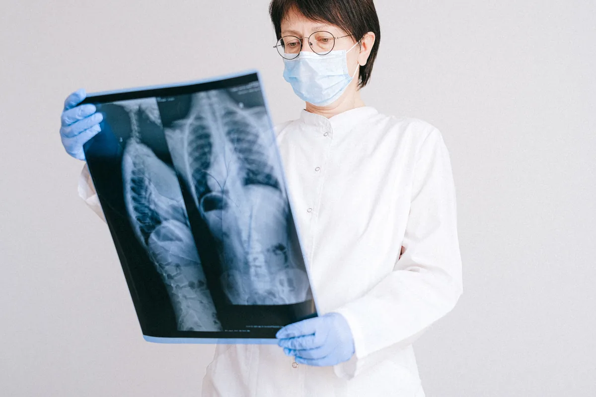 A masked clinician holding up an X-ray film of the spine and studying it.