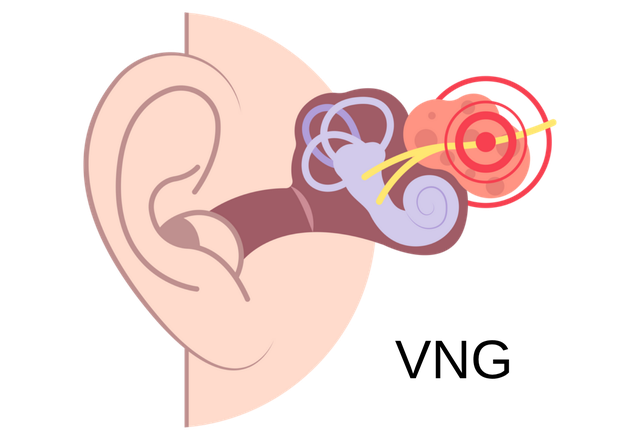 Measura VNG assessment